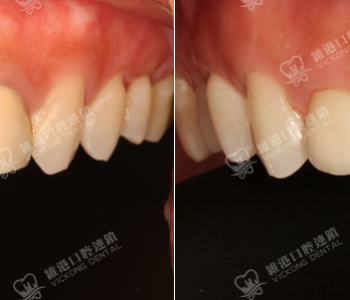 維港口腔