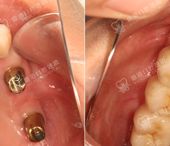 維港口腔