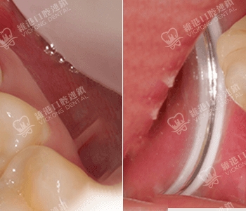 維港口腔