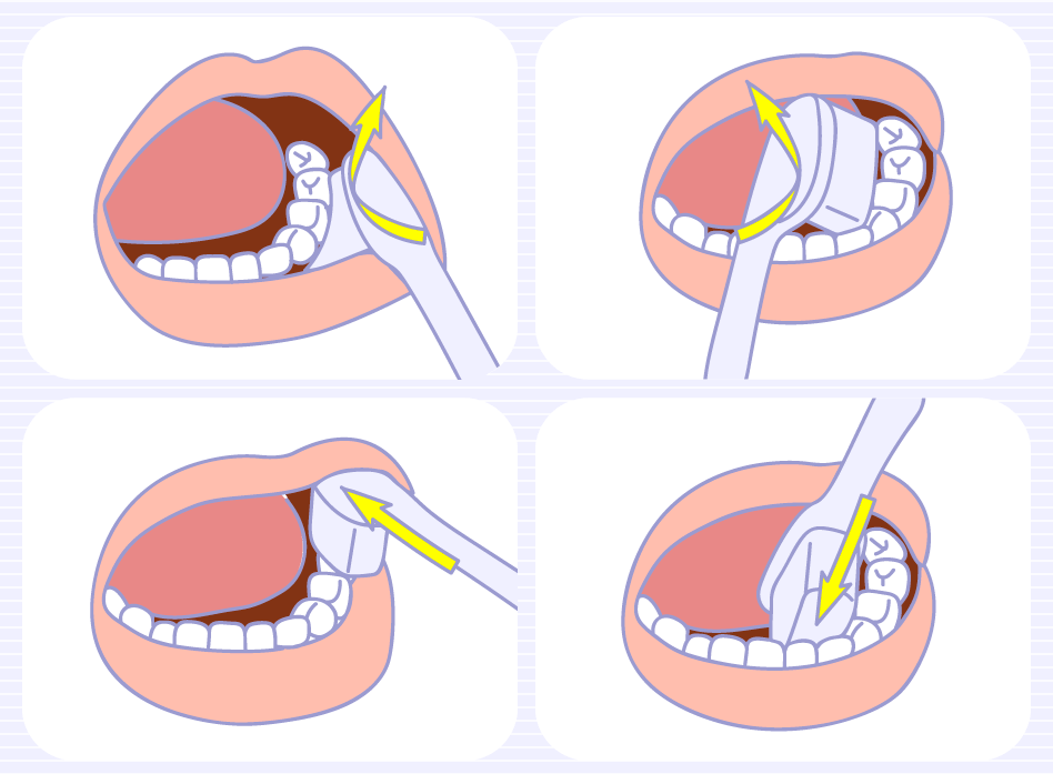 vickongdental_implant14.jpg