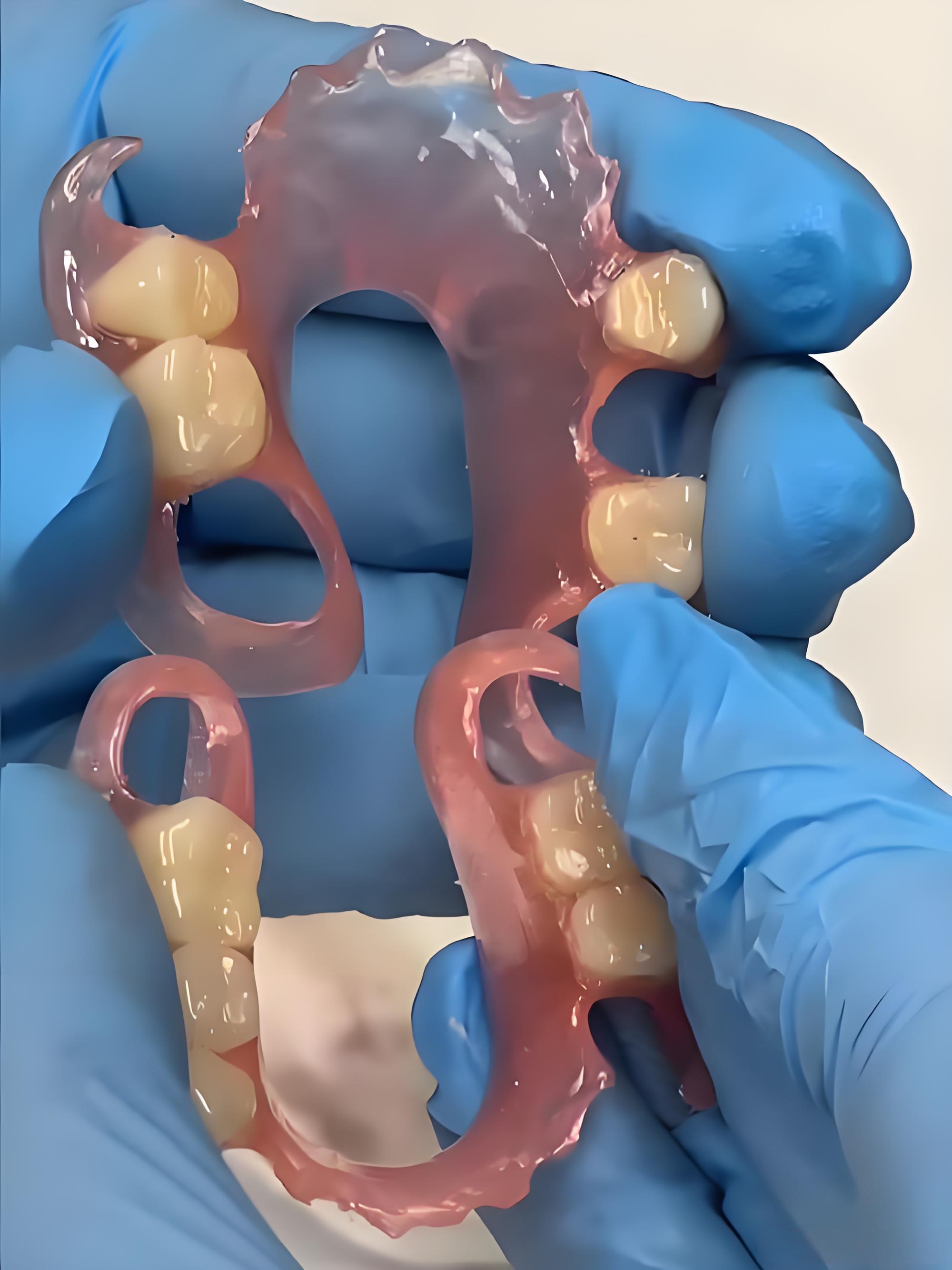 活動假牙.jpg 活動假牙.jpg