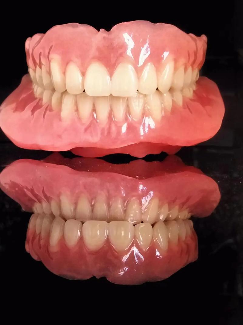 吸附性義齒.jpeg