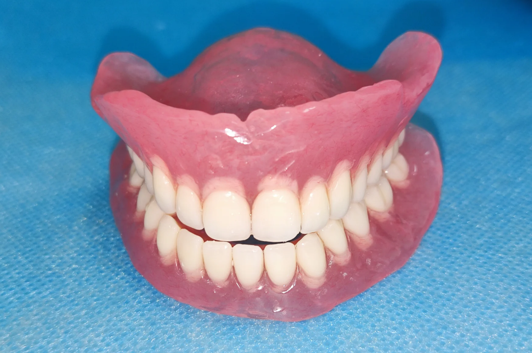 活动假牙 活动假牙